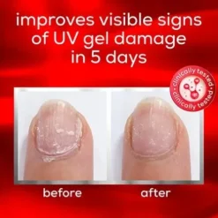 Essie To The Rescue Tratamento Reparador De Unhas