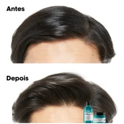 L’Oréal Pro Serie Expert Scalp Advanced Argila 2 Em 1 Para Cabelo Oleoso