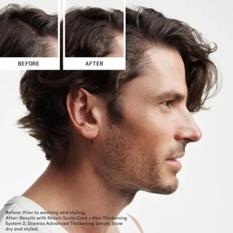 Nioxin Sistema 2 Condicionador Para Cabelo Natural Com Perda Densidade